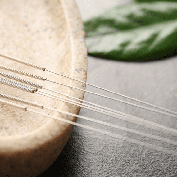 Acupuncture needles prepared for winter wellness use