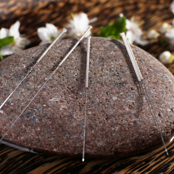 Acupuncture needles on stone