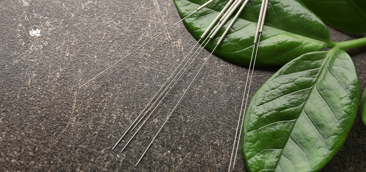 Acupuncture for Lymphatic Drainage